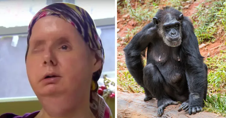 Woman who had face ripped off by friend's pet chimp A Disturbing Cautionary Tale: A Woman’s Face Mauled by a Friend’s Pet Chimp