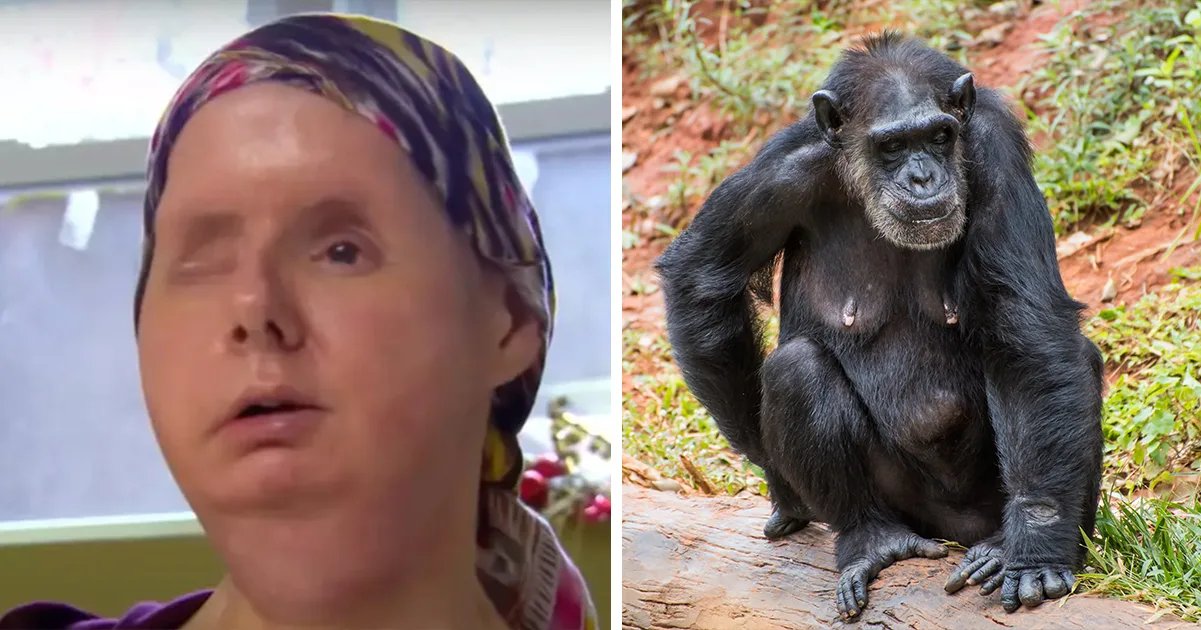 A Disturbing Cautionary Tale: A Woman’s Face Mauled by a Friend’s Pet Chimp